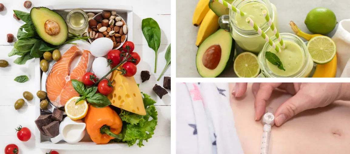¿Cómo alimentar a un niño con daño cerebral? 7 Alimentos y bebidas adecuadas para niños con parálisis cerebral